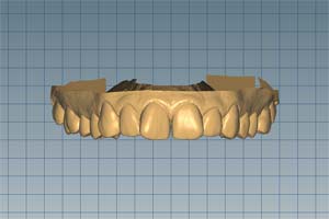 CAD Verfahren